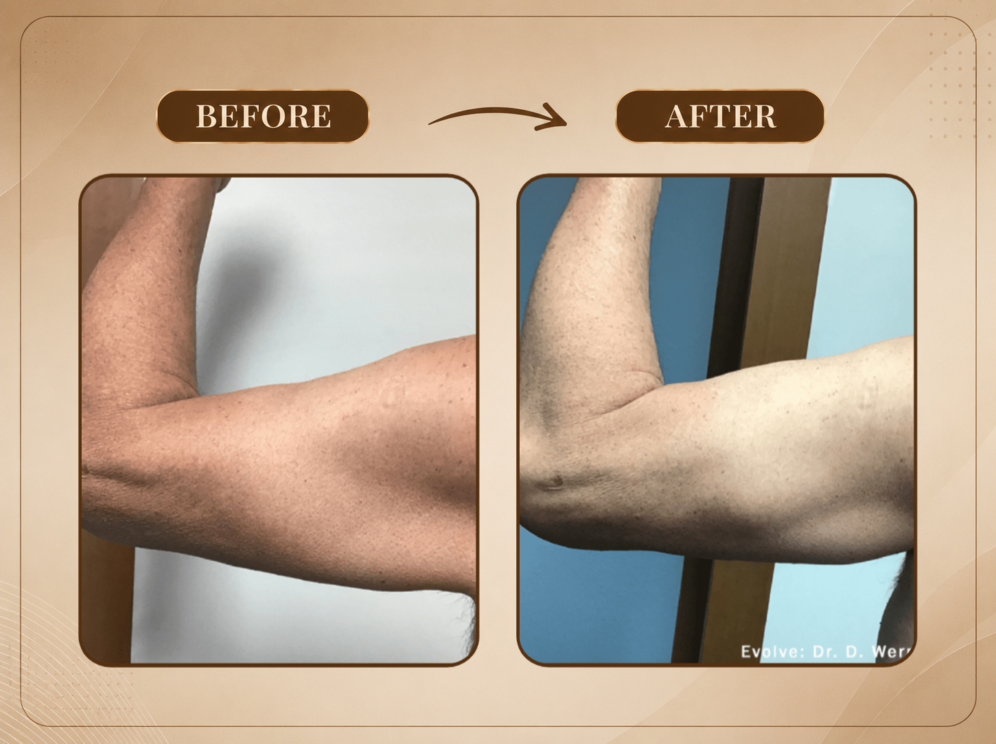 Treatment Result 1