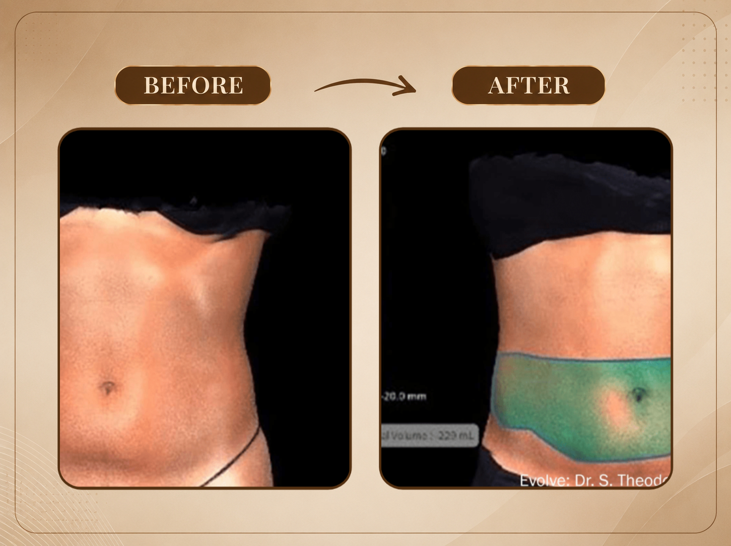 Treatment Result 2