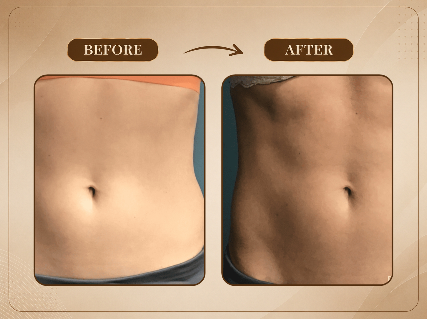 Treatment Result 3